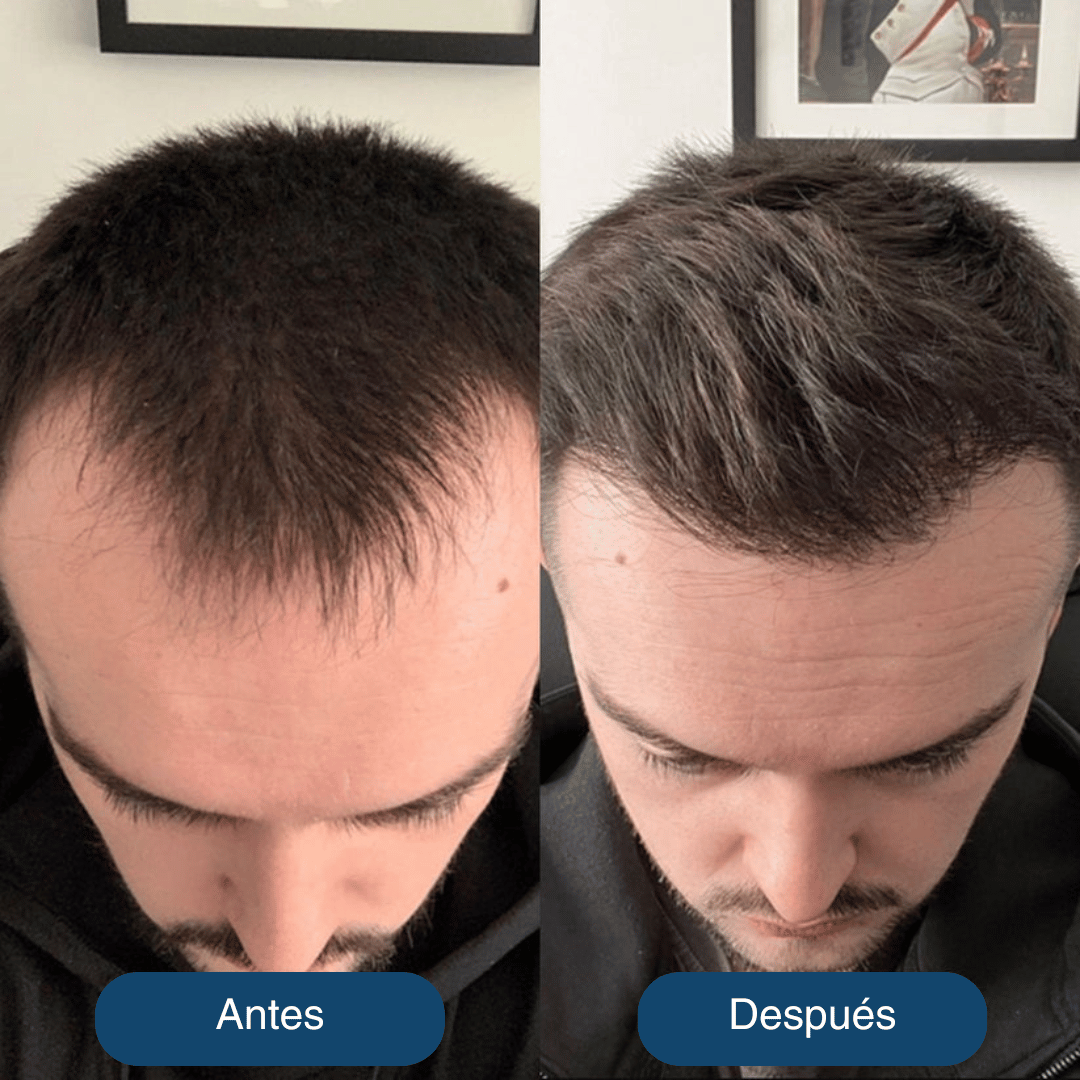 REHAIR | Serum Roll-On Recupera Cabello