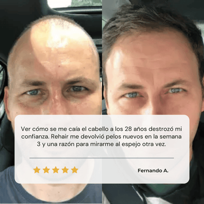 REHAIR | Serum Roll-On Recupera Cabello